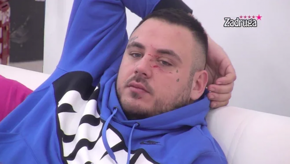 EVO KAKO IZGLEDA CAR NAKON MAJINOG NAPADA Filip na Badnji dan urnisan, leži u podlivima i ogrebotinama, ne može da dođe sebi!