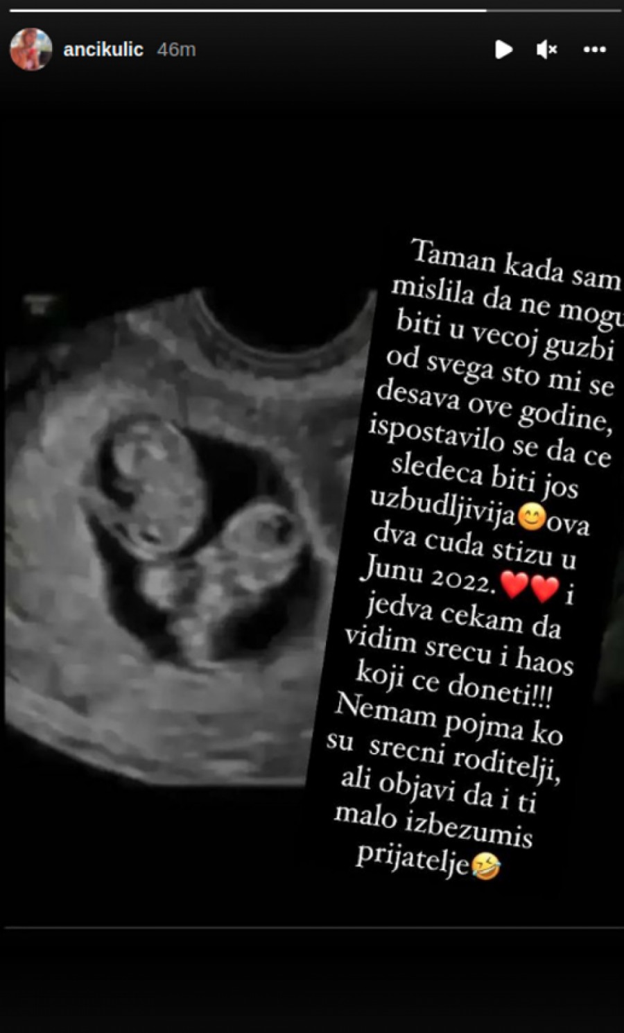 ANA KULIĆ SAOPŠTILA SVIMA DA JE TRUDNA! Sestra Miljane Kulić objavila fotku sa ultrazvuka, biće veselja u junu!