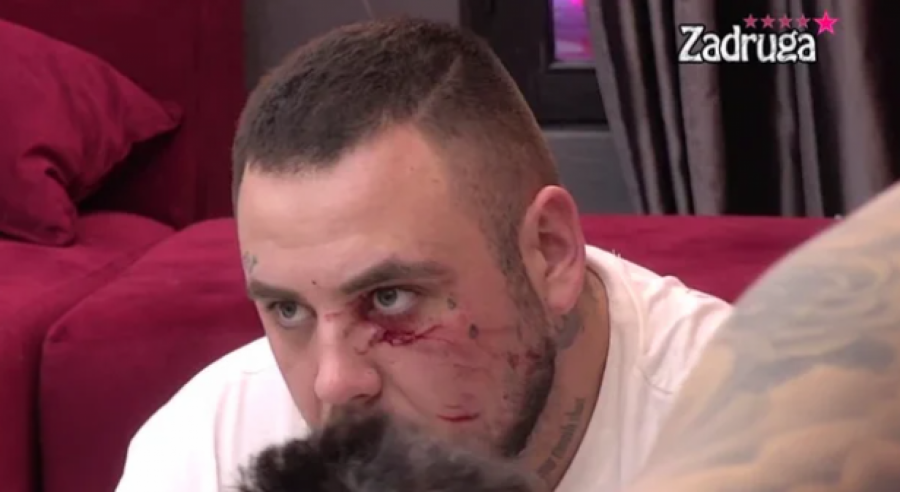 PSIHIJATAR PROGOVORIO O MAJI MARINKOVIĆ: Mogu se desiti i samoubistva, duševno oboleli pacijenti dižu gledanost!