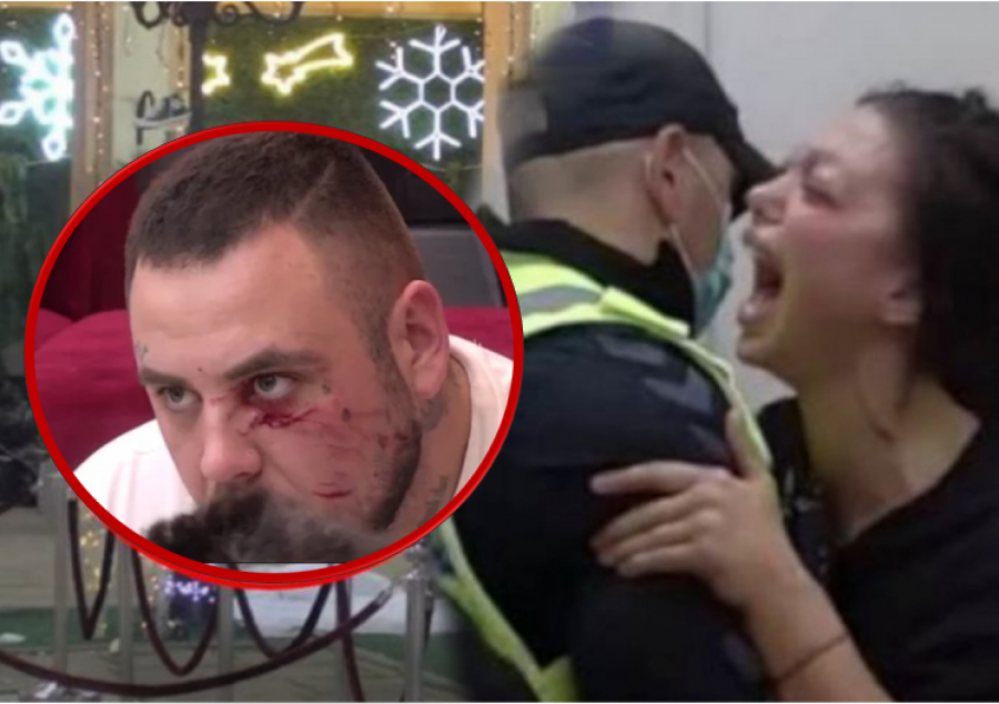 TOTALNI KOLAPS! Filipovo lice skroz krvavo! Izbila tuča u Beloj kući nakon žurke,  uletelo obezbeđenje!