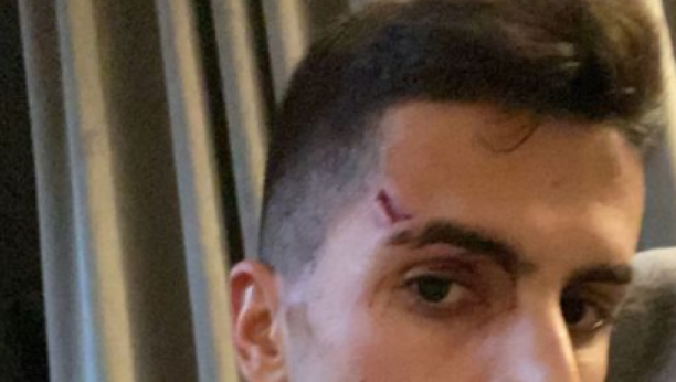 DRAMA U ENGLESKOJ! Zvezda Sitija pretučena i opljačkana u svojoj kući! (FOTO)