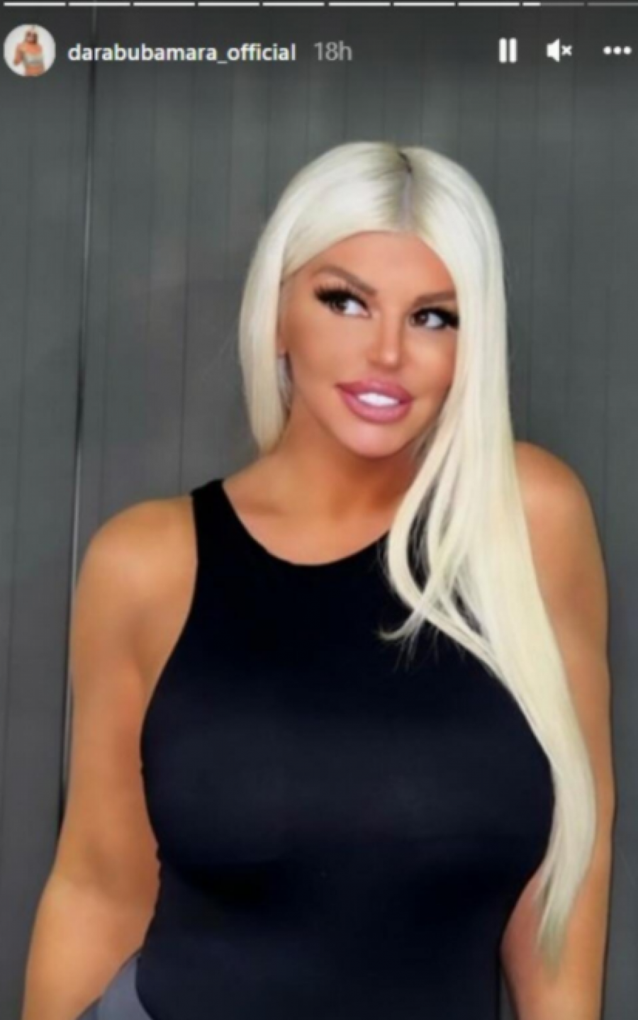 DARA NEPREPOZNATLJIVA! Pevačica se fotošopirala do bola, promenila usne, nos, jagodice, komentari samo pljušte!