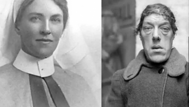 POSTALA JE "NAJRUŽNIJA ŽENA NA SVETU" PREKO NOĆI Zbog svog izgleda je izgubila posao, a malo ljudi je znalo da je ozbiljno bolesna