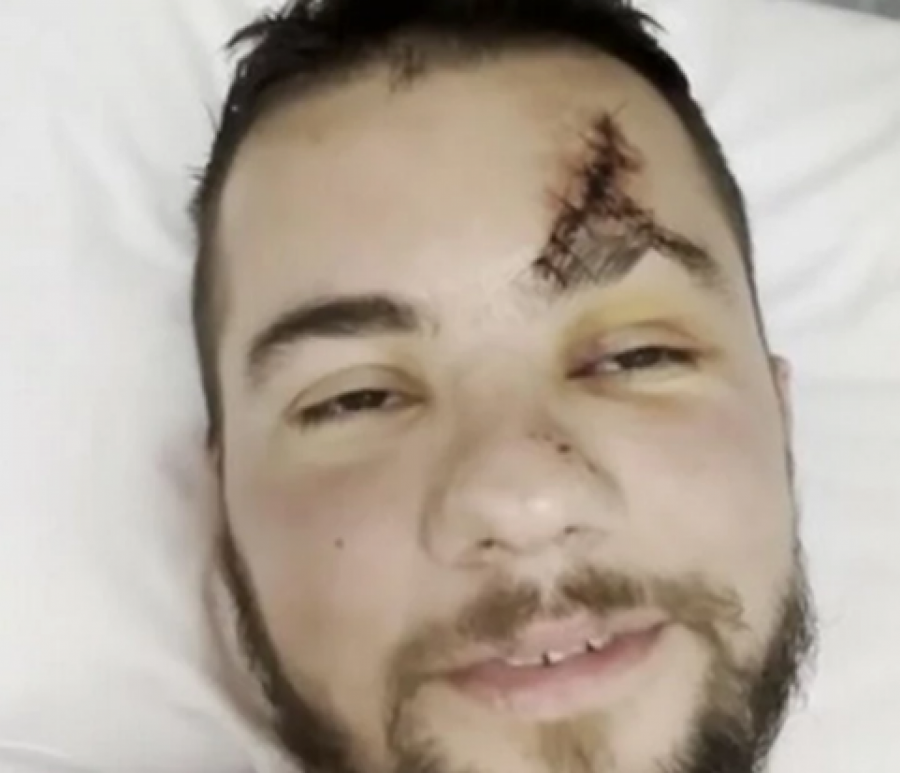 STRAVA I UŽAS! Takmičar poznatog šoua pao sa 20 metara visine, hitno prevezen u bolnicu!