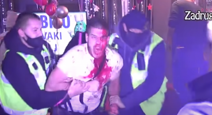 ISPLIVALE JEZIVE FOTOGRAFIJE Dejan krije stravične povrede glave, kamera sve zabeležila! (FOTO)