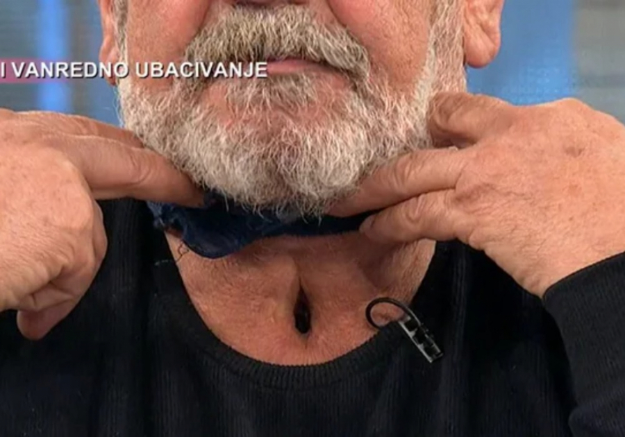 MLADEN JE GREŠKOM LEKARA OSTAO BEZ DELA GRLA Tokom celog slučaja, bilo prisutno niz nepravilnosti (UZNEMIRUJUĆE FOTOGRAFIJE)