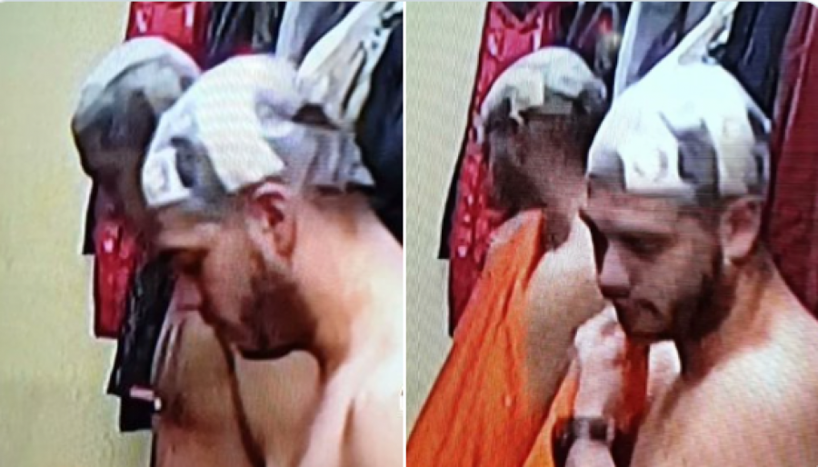 ISPLIVALE JEZIVE FOTOGRAFIJE Dejan krije stravične povrede glave, kamera sve zabeležila! (FOTO)