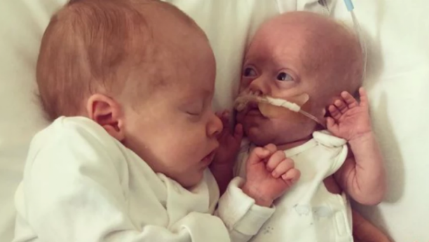 PRERANO ROĐENI DEČAK SE BORI ZA ŽIVOT: Zastaće vam dah kad vidite šta njegov brat blizanac radi za njega