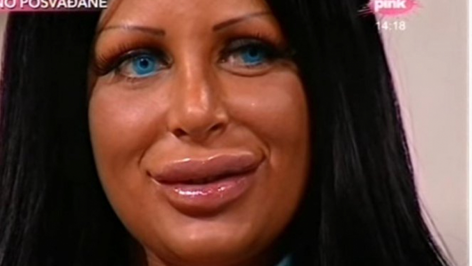 UNIŠTILA SE OPERACIJAMA, ZVALI SU JE KRALJICOM SILIKONA Tukla se sa Kristijanom Golubovićem, a Tijana Đurić je danas neprepoznatljiva (FOTO)