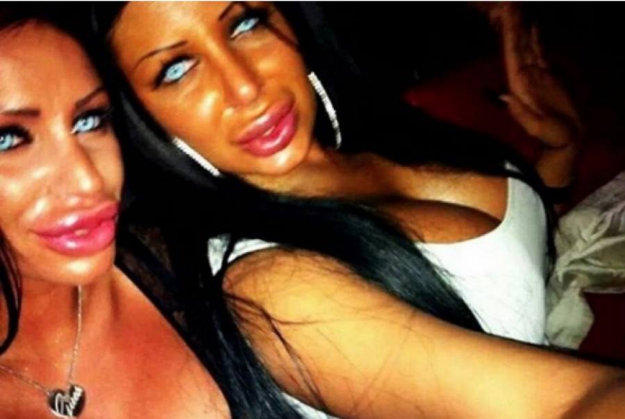 SEĆATE LI SE KRALJICE SILIKONA? VIŠE NE IZGLEDA OVAKO! Starleta izvadila implante i plava sočiva, nikada je ne biste prepoznali!