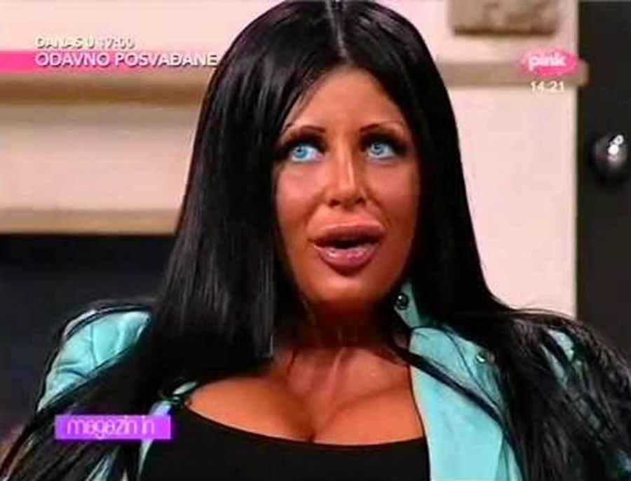 SEĆATE LI SE KRALJICE SILIKONA? VIŠE NE IZGLEDA OVAKO! Starleta izvadila implante i plava sočiva, nikada je ne biste prepoznali!