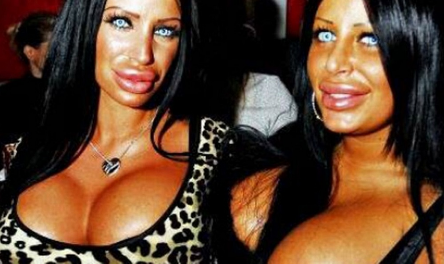 KRALJICU SILIKONA VIŠE NI ROĐENA MAJKA NE BI PREPOZNALA! Bila na Farmi, Kristijan Golubović nasrnuo na nju, a onda odjednom nestala, evo kako sada izgleda (FOTO)