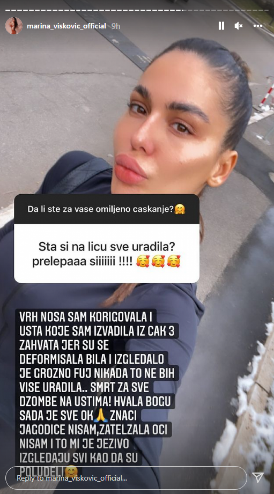 SVI IZGLEDAJU KAO DA SU POLUDELI! Marina Visković otkrila šta je operisala sve na licu, a za jednu stvar nije sigurna da neće opet! (FOTO)
