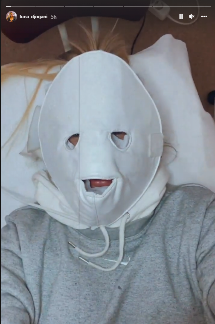 ZASIJALA! Luna Đogani se podvrgla estetskim tretmanima, pa oduševila sve rezultatom! (FOTO)