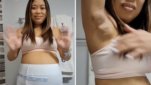 "BILA SAM U ZASTRAŠUJUĆIM BOLOVIMA, A PAZUSI SU BILI PUNI MLEKA" Žena otkrila neobičanu pojavu nakon porođaja!