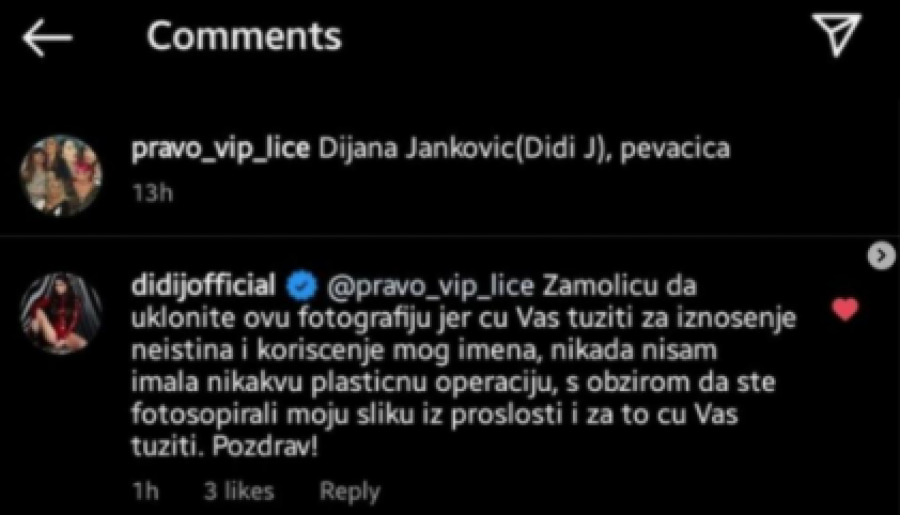 DIDI IZGORELA OD BESA! Pevačica zapretila tužbom zbog upoređivanja: Nisam imala ni jednu jedinu operaciju!