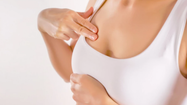 NIJE REČ O KVRŽICAMA Obratite pažnju na tri zabrinjavajuće promene na koži, mogu da budu povezane sa kancerom dojke!