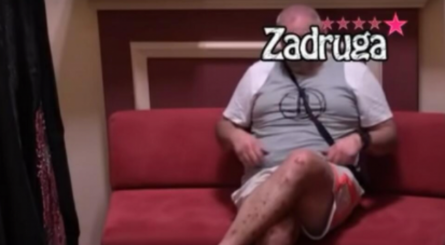 JEZIV PRIZOR! Miki Đuričić ima žive rane po telu, zdravstveno stanje mu se pogoršalo, evo na šta sumnja! (FOTO)