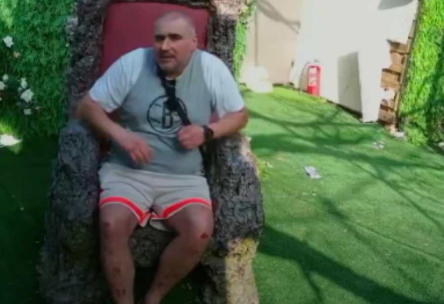 JEZIV PRIZOR! Miki Đuričić ima žive rane po telu, zdravstveno stanje mu se pogoršalo, evo na šta sumnja! (FOTO)