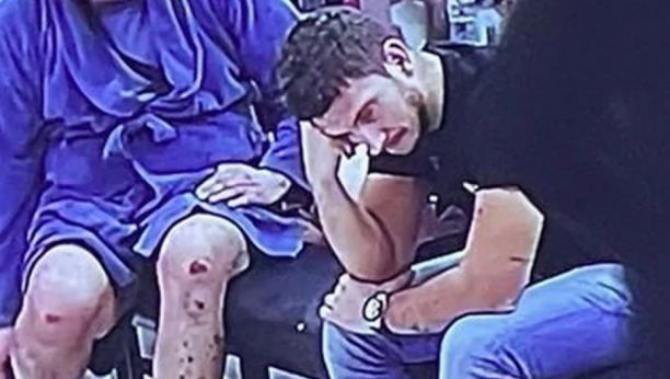 POTRESNE SLIKE Miki Đuričiću rane se počele otvarati i po glavi, doktori otkrili sve o ovoj neizlečivoj bolesti