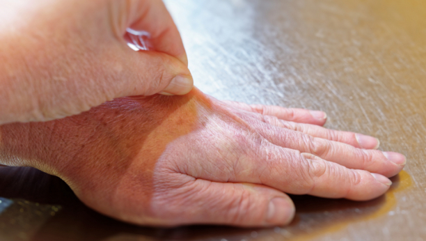 Uradite ovaj jednostavan test i proverite da li vam je telo dovoljno hidrirano!