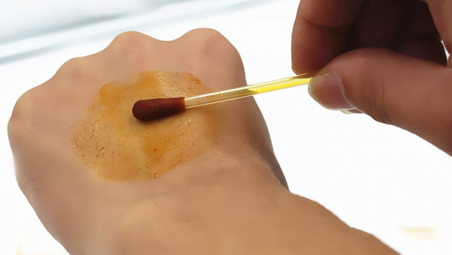 PROVERITE RAD ŠTITNE ŽLEZDE Namažite jod na ruku i posmatrajte šta se dešava