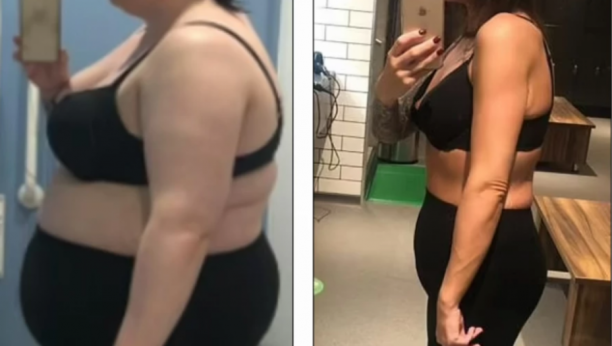 SRBI OVU GREŠKU  PRAVE SVAKI DAN Sve smo deblji i deblji, a ovo nam poručuju ljudi koji su ekstremno smršali!