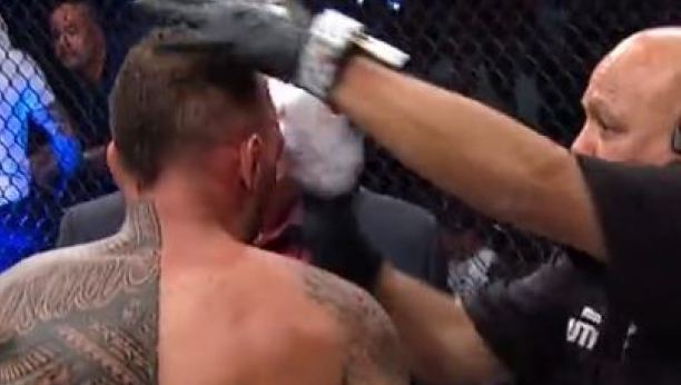 LUDAK ILI NAJHRABRIJI ČOVEK? MMA borac krvario na sve strane, a onda je uradio nešto nezamislivo kada mu je doktor prišao sa peškirom! (VIDEO)