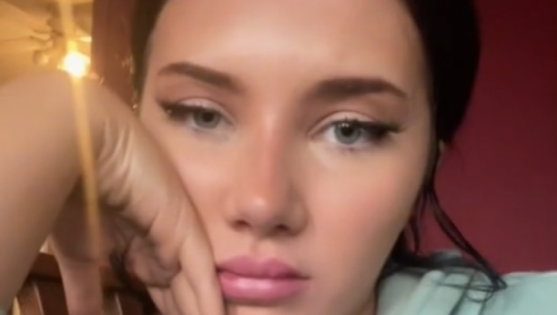 IMA SAMO 25 GODINA A LICE JOJ JE VEĆ UNIŠTENO OD BOTOKSA Pet godina već ubrizgava filere koji su joj deformisali facu