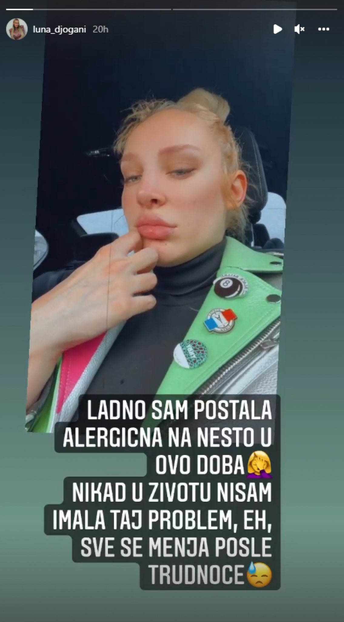 LUNA ĐOGANI IMA ZDRAVSTVENIH PROBLEMA! Evo šta joj se događa nakon porođaja, svi zabrinuti! (FOTO)