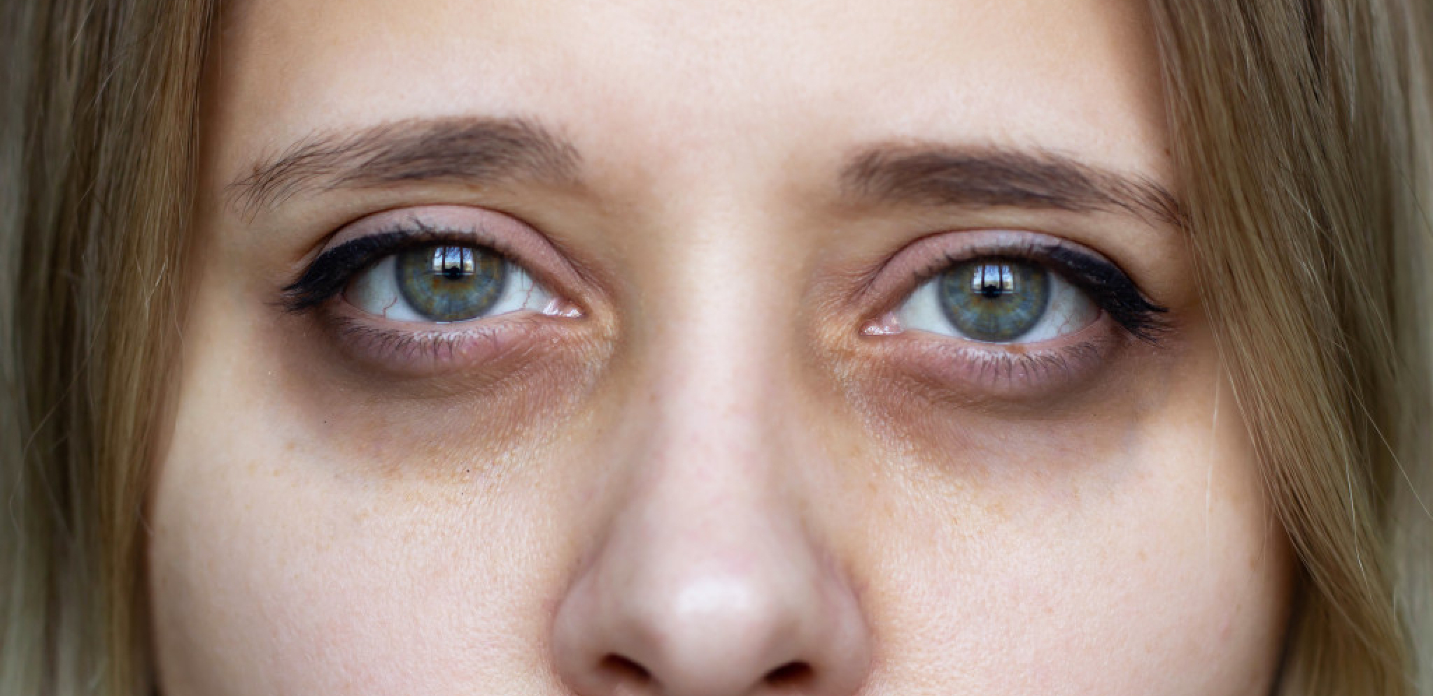 Cijanoza Alo rs cijanoza-alo-rs