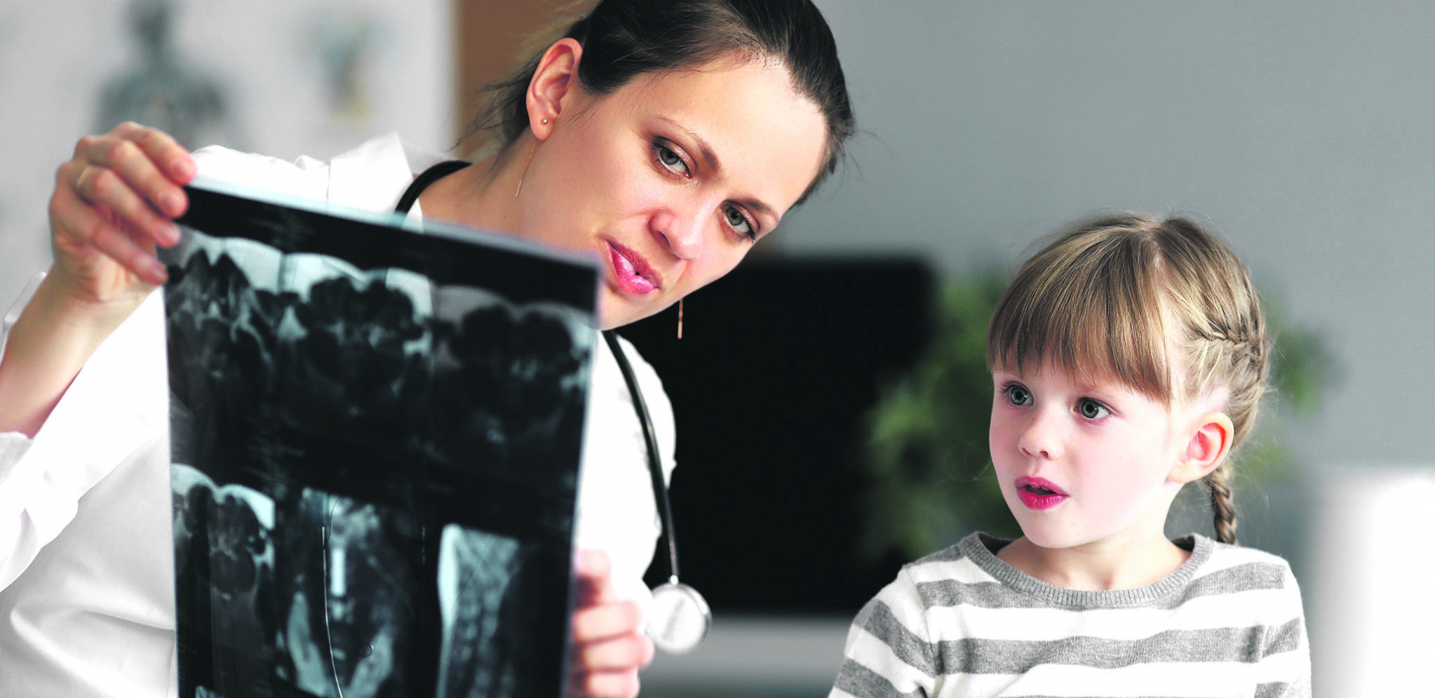 POČNITE NA VREME Fizička aktivnost kod najmlađih može preduprediti probleme sa deformitetima kičmenog stuba