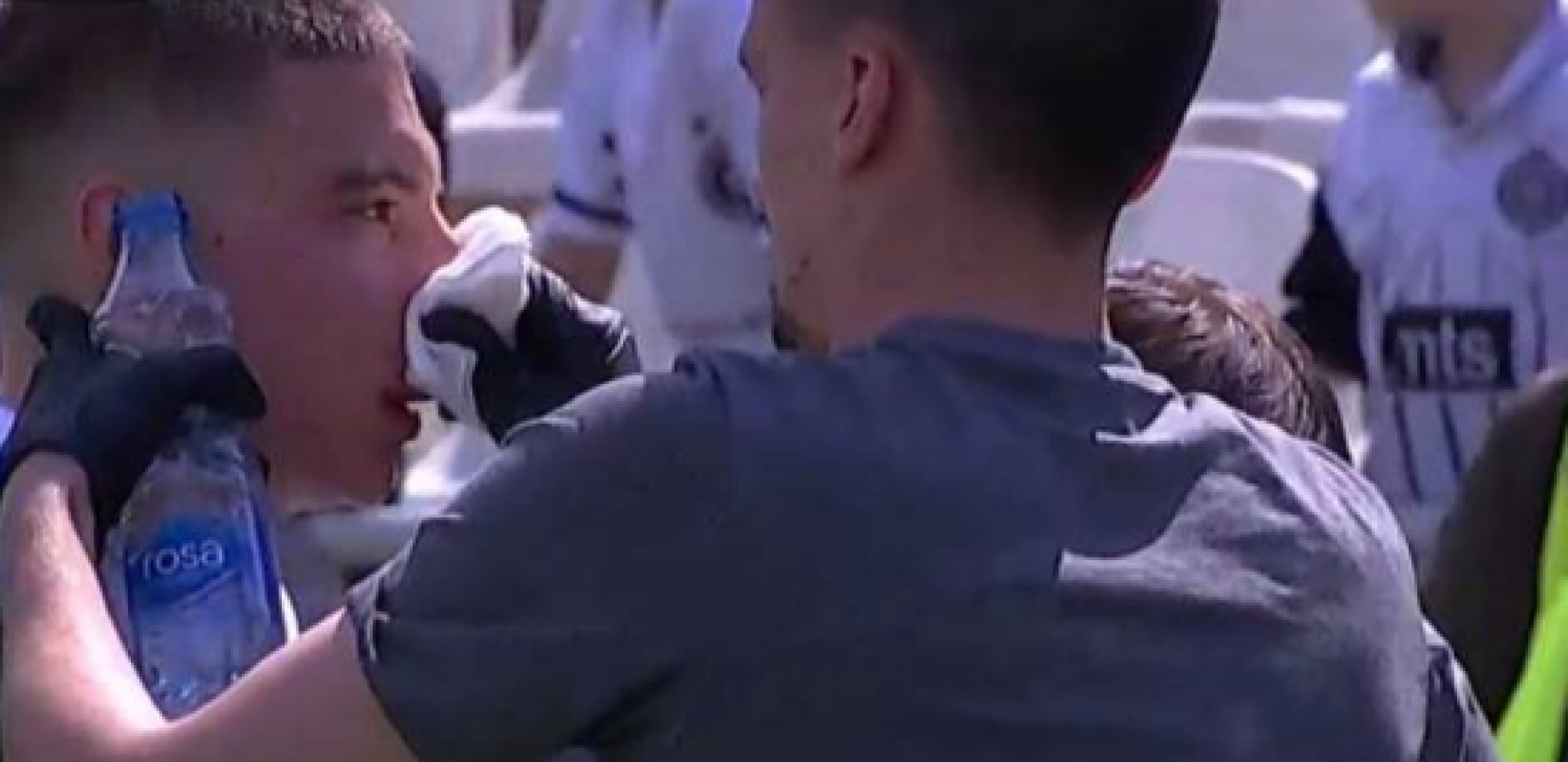 OŠTRO U HUMSKOJ! Terzić završio krvav (FOTO)