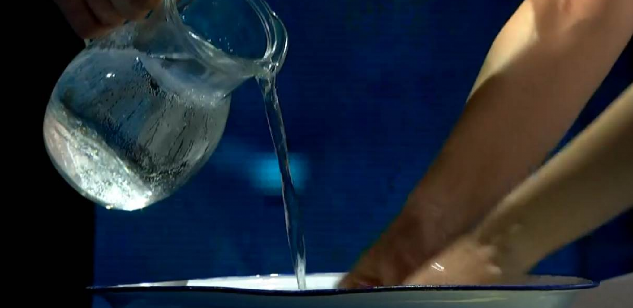 STAVILA JE RUKU U MEŠAVINU VODE I SIRĆETA Tri puta nedeljno je kvasiila je prste, upala i bolovi su nestali