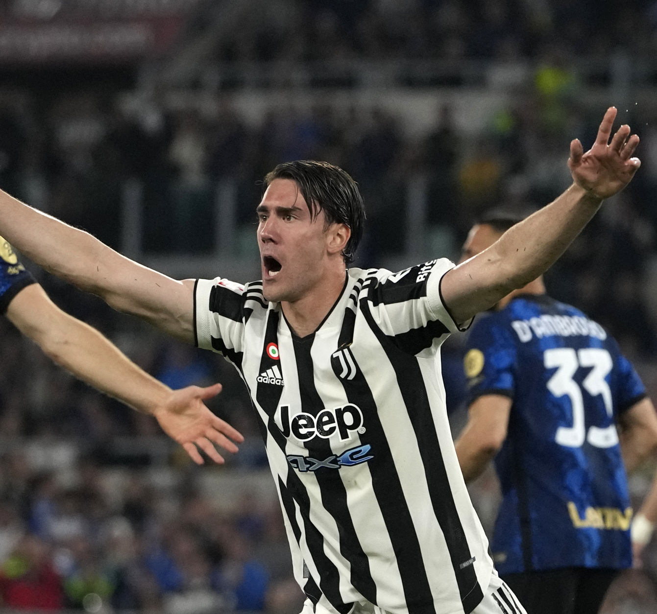 CELA SRBIJA JE NA NOGAMA Alegri otkrio pravo stanje povrede Dušana Vlahovića