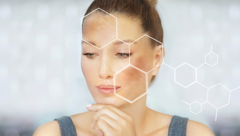 Ne pravite ovu grešku: Ukoliko imate fleke na koži, izbegavajte ova tri sastojka za negu