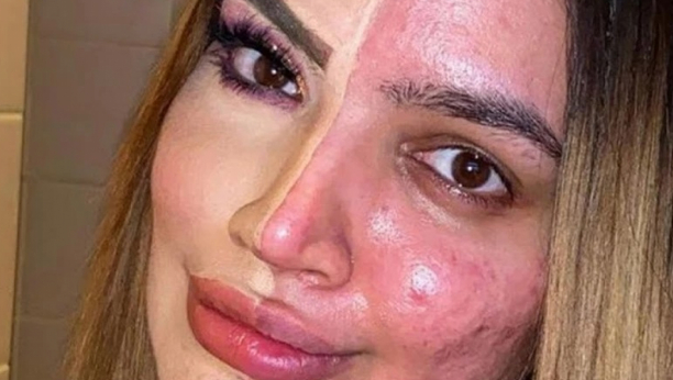 "ZVALI SU ME HODAJUĆA BOLEST": Kada je infuenserka prestala da koristi filtere i pokazala svoje lice, ljudi su reagovali veoma burno