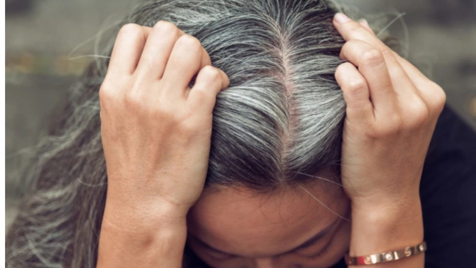 OVO SU RAZLOZI ZAŠTO VAM KOSA SEDI Ukoliko imate previše belih dlaka, odmah u bolnicu