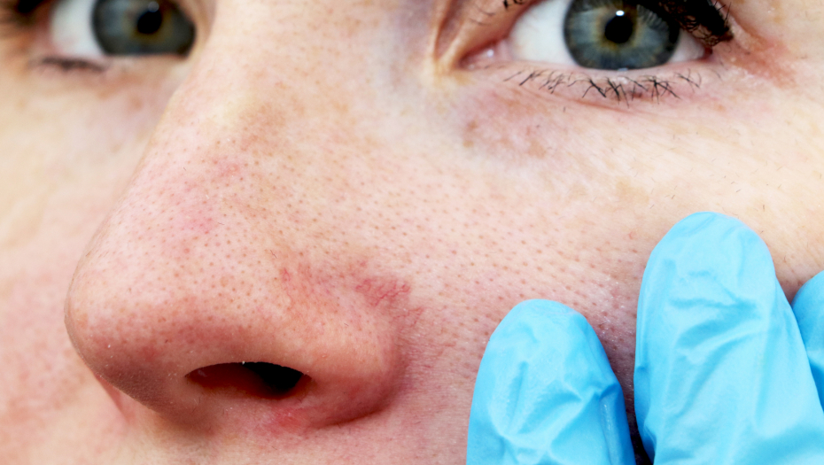 LEKARI GA ZOVU "TROUGAO SMRTI" Ovo skoro svi radimo, a nismo svesni da može biti fatalno