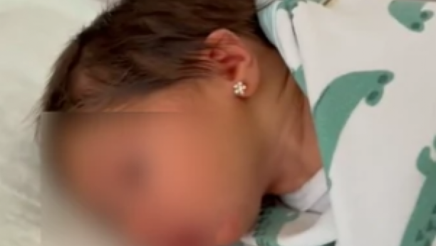 "PROBUŠILI SU JOJ UŠI PRE NEGO ŠTO SU PRESEKLI PUPČANU VRPCU" Hajka na mladu majku zbog bebinih minđuša!