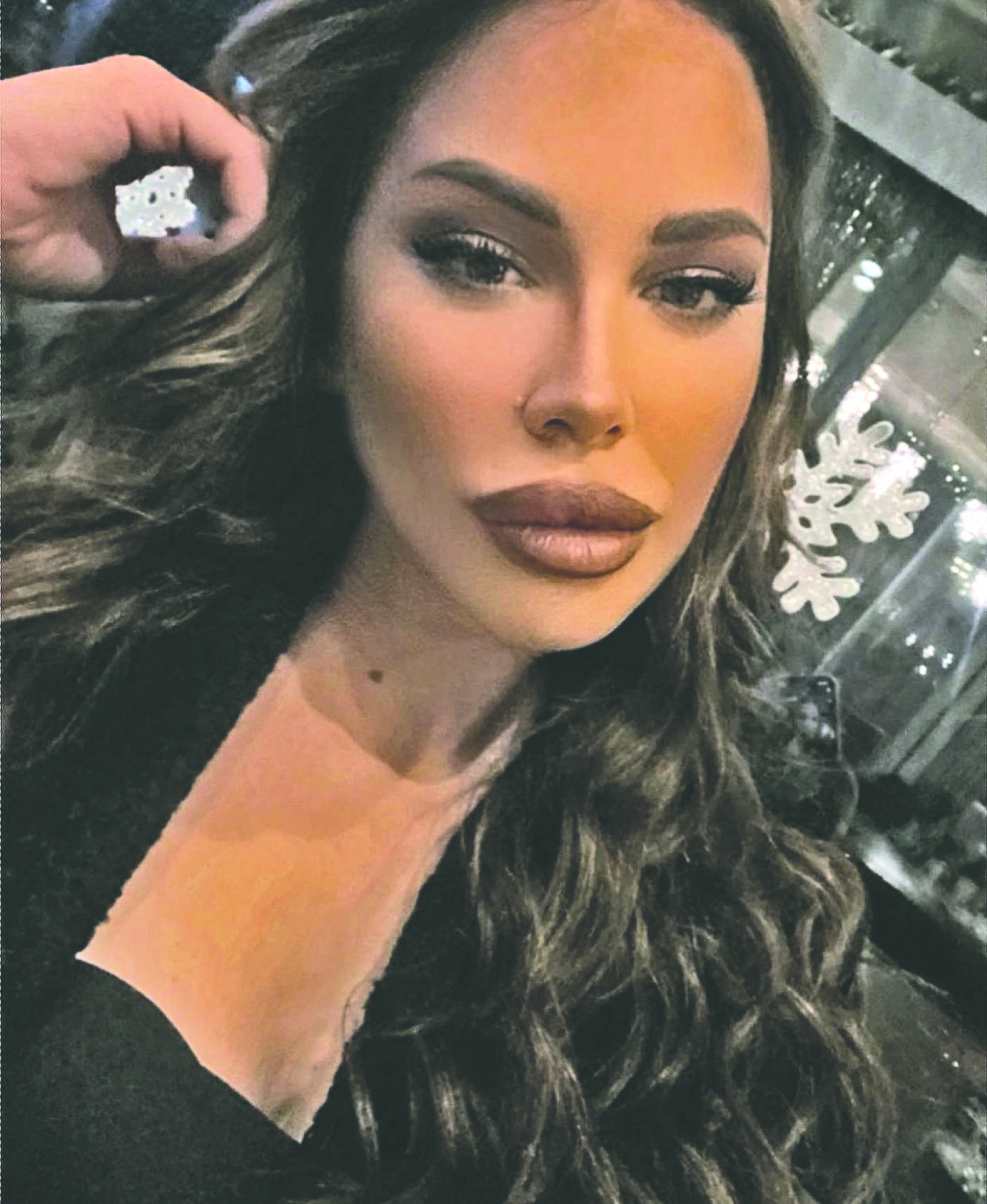 VUKAO JE PO ULICI, GLAVOM JOJ POLOMIO NOS Bivša zadrugarka Olga Margetić pretrpela brutalno nasilje