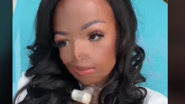 ZBOG ŠAMPONA ZA KOSU ZAVRŠILA JE U KOMI Ako i vi koristite ovakav možda bi trebalo da prestanete!