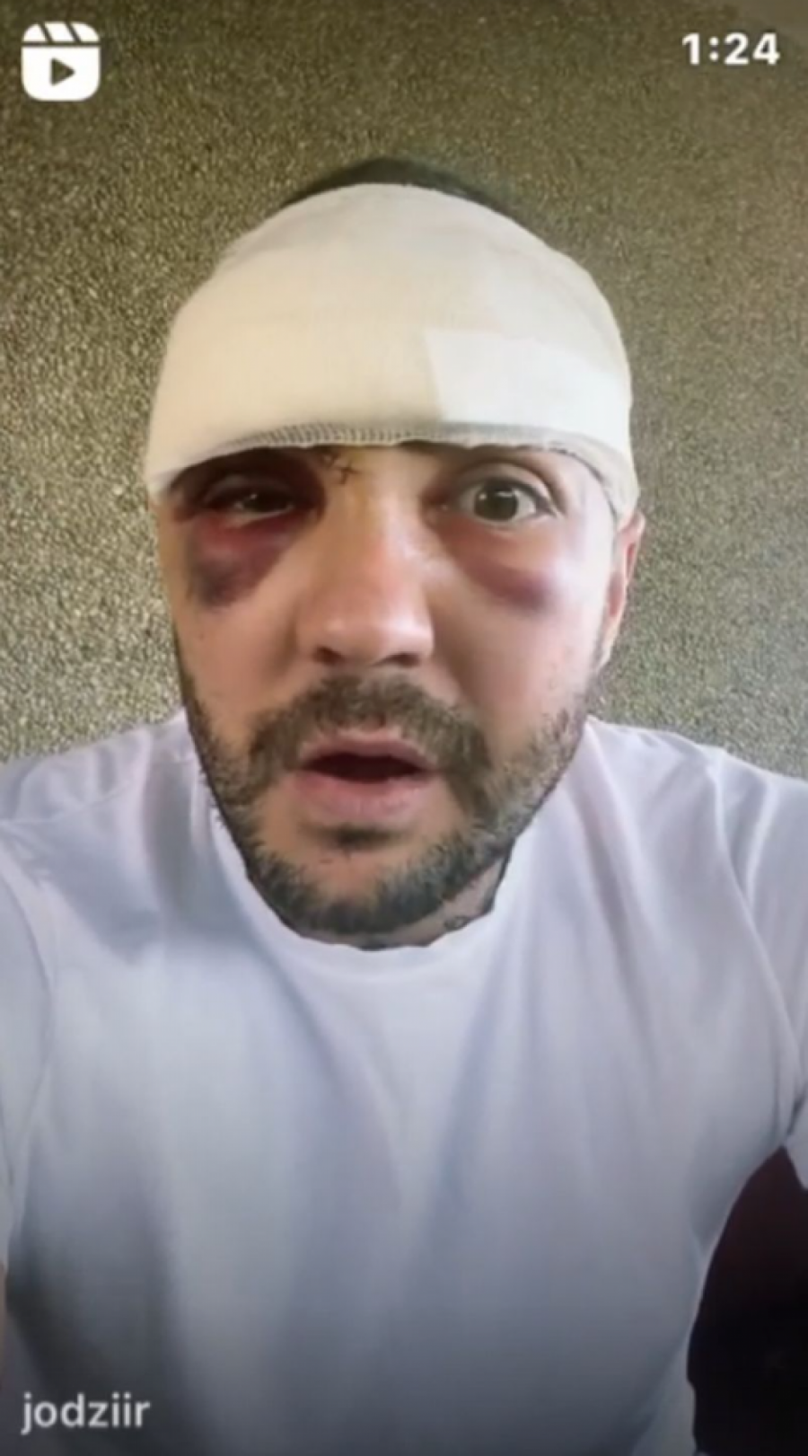 INFLUENSERA POTERAO MALER Jovan Radulović pre nekoliko dana doživeo je nezgodu, a sada je njegova ćerka u bolnici: MOJA BEKA JE LAV NAJJAČI! (FOTO)