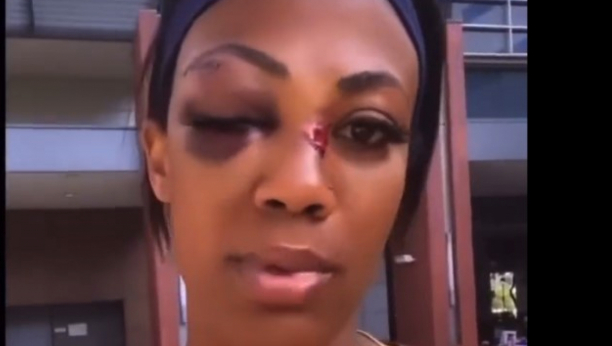 DOGODILO SE VEOMA BRZO Nepoznati muškarac prebio bivšu američku odbojkašicu (VIDEO)