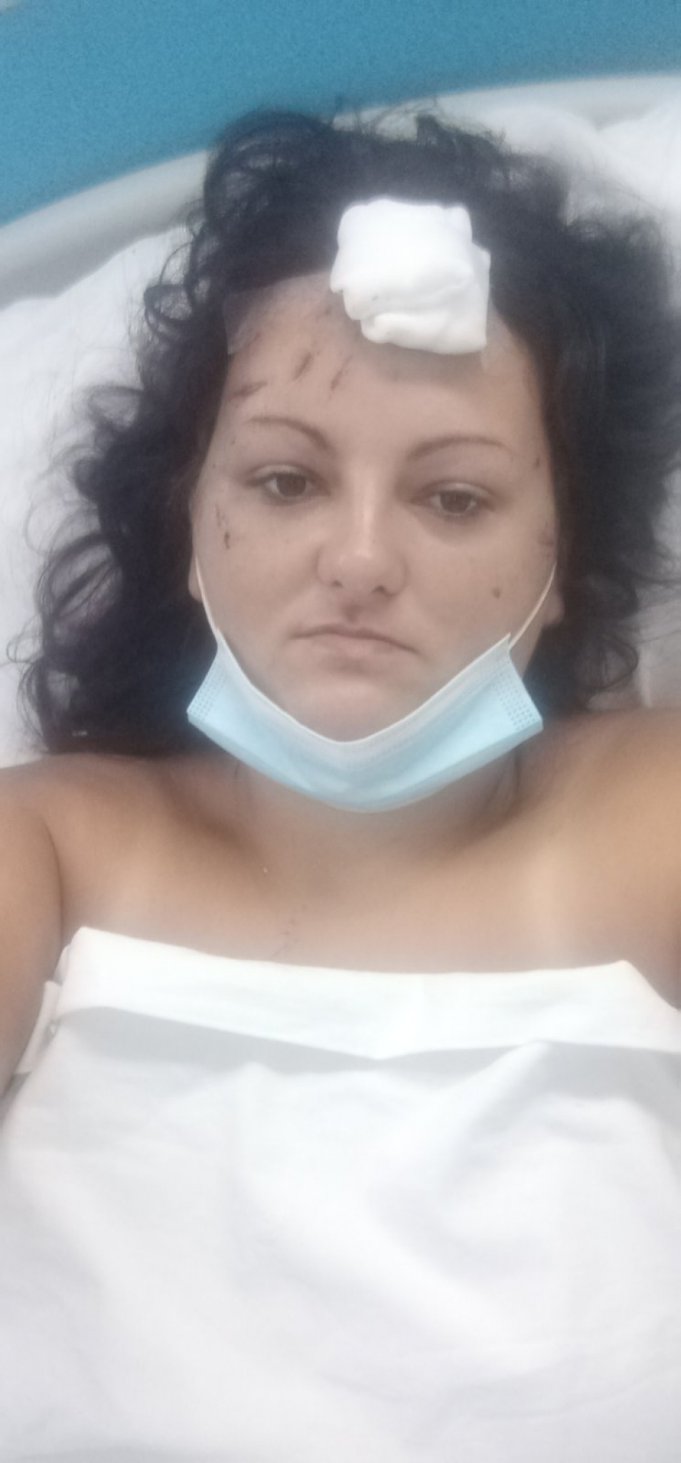 Dragana Vasić, koja je pala sa litica kod Manastira Ostrog i preživela pad sa stotinak metara, ponovo hoda