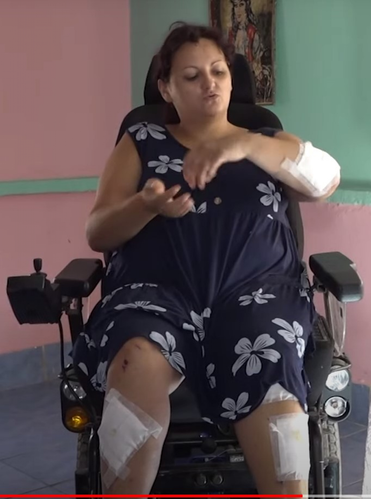 Dragana Vasić, koja je pala sa litica kod Manastira Ostrog i preživela pad sa stotinak metara, ponovo hoda