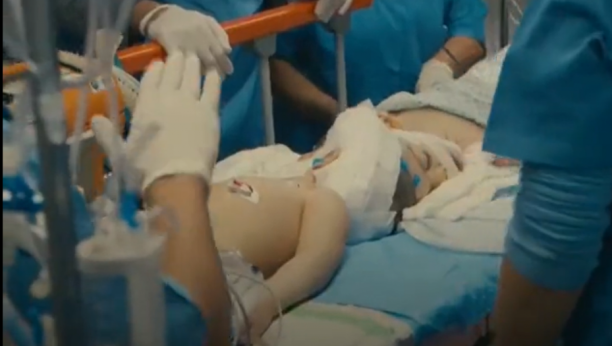 GLAVE SU IM BILE SPOJENE Nakon više od 25 sati na operacionom stolu, lekari su uspeli da razdvoje sijamske blizance (VIDEO)
