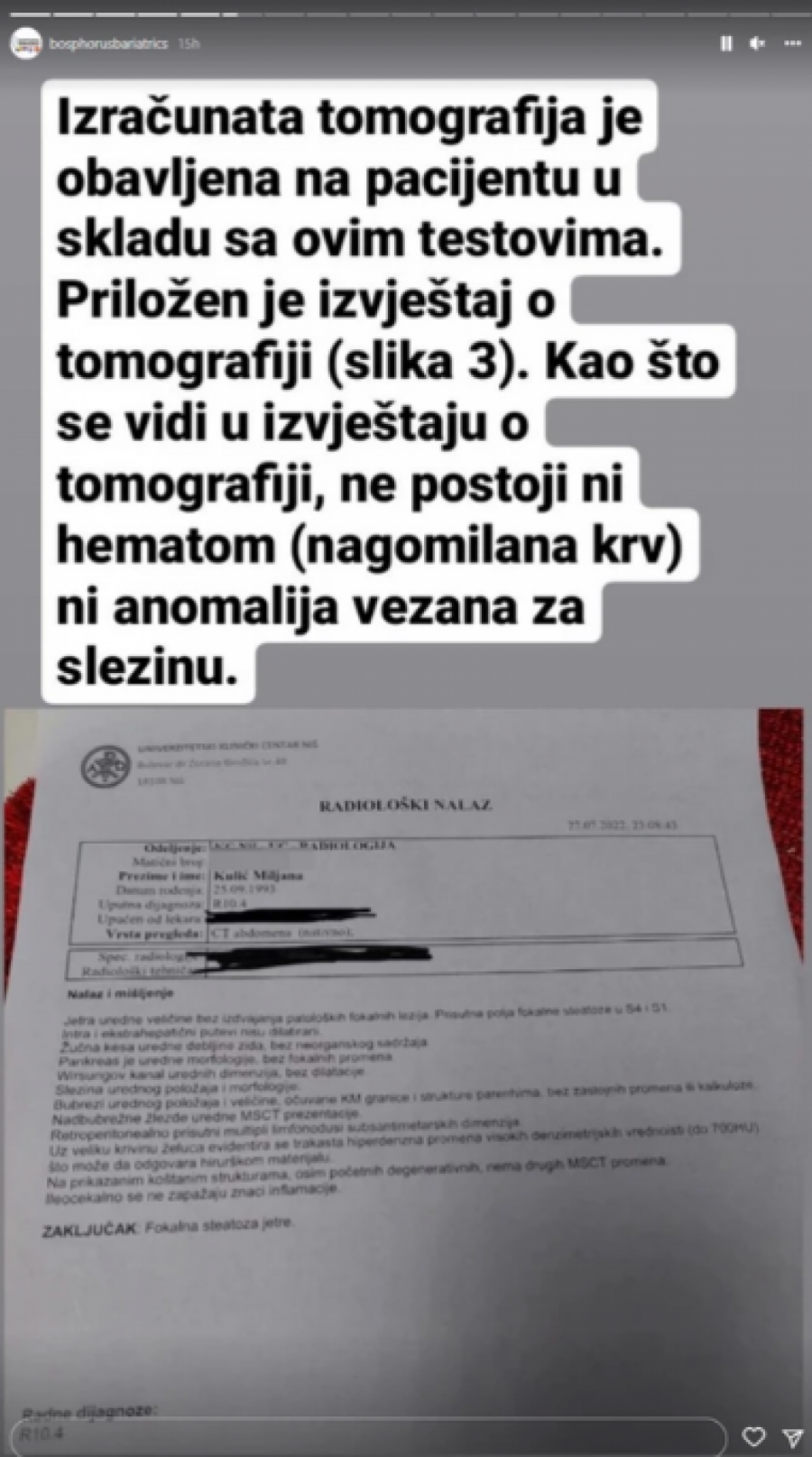 BOLNICA IZNELA DOKAZE Operacija prošla bez komplikacija i krvarenja, Marija Kulić vređala doktora iz Turske: Ima trombozu majmune
