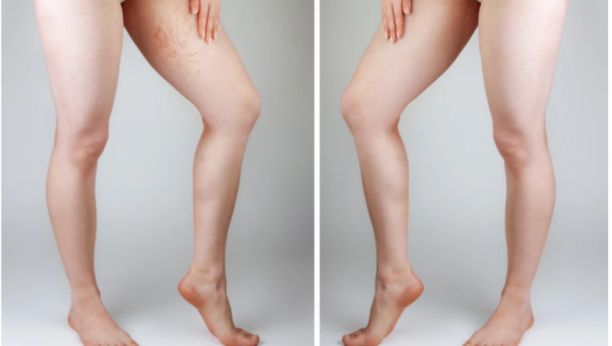 AKO VIDITE OVE PROMENE NA TELU PROVERITE ŠEĆER Prve simptome dijabetesa ljudi obično ne primete ili misle da je drugi problem u pitanju