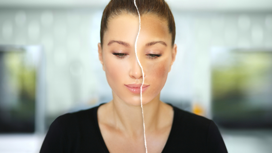 DERMATOLOZI JE PREPORUČUJU Utrljajte ovu kremu na ožiljak ili fleku na koži, nestaće za samo nekoliko minuta